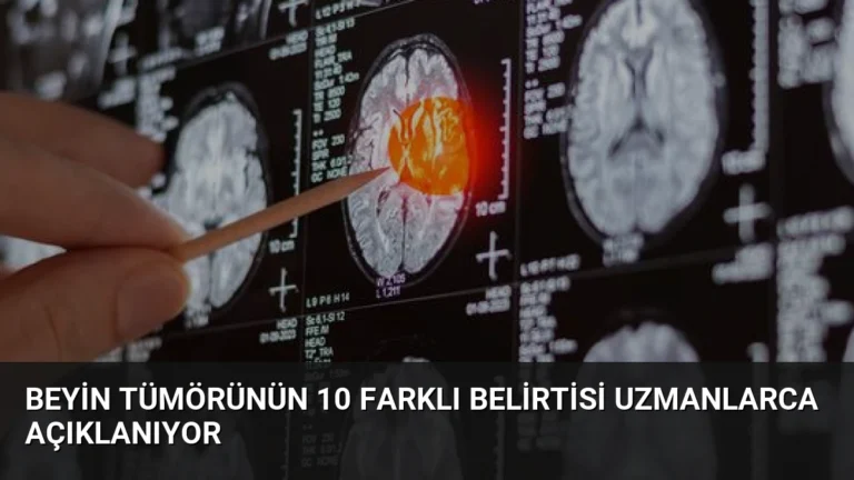 Beyin Tümörünün 10 Farklı Belirtisi Uzmanlarca Açıklanıyor