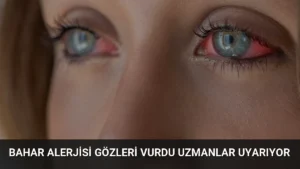 Bahar Alerjisi Gözleri Vurdu Uzmanlar Uyarıyor